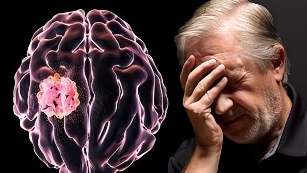 حين يتحول التوتر والقلق إلى عدو صامت للدماغ